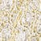 GOLD/ SILBER