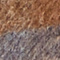 BRAUN/ GRAU/ BLAU