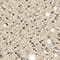 CREME/ SILBER