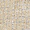 GOLD/ SILBER