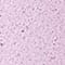 LIGHT PINK/ SILVER