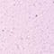 LIGHT PINK/ SILVER