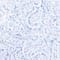 LIGHT BLUE/ WHITE